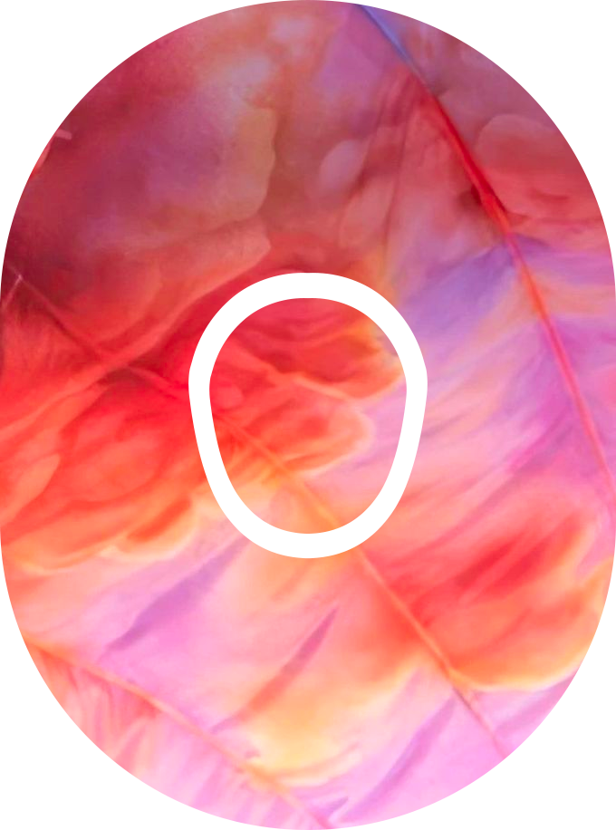 Taylor Swift Eras Tour-Inspired Diabetes Overpatch for Dexcom G7/G6, Libre, and Omnipod